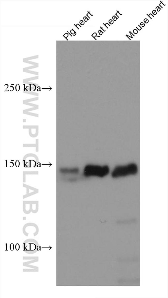 MYBPC3 Antibody in Western Blot (WB)