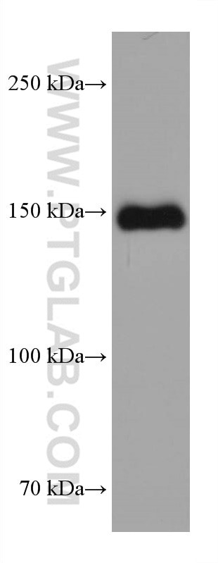 MYBPC3 Antibody in Western Blot (WB)