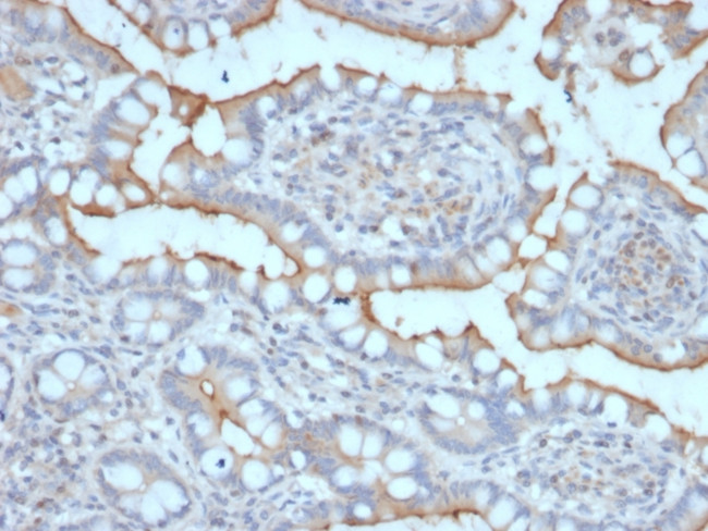 StAR (Steroidogenic Acute Regulator) (Leydig Cell Marker) Antibody in Immunohistochemistry (Paraffin) (IHC (P))