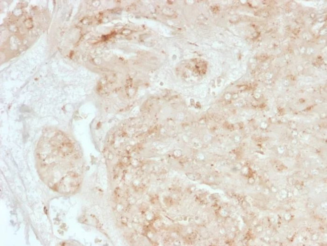 StAR (Steroidogenic Acute Regulator) (Leydig Cell Marker) Antibody in Immunohistochemistry (Paraffin) (IHC (P))