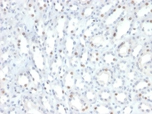 STAT6 (Solitary Fibrous Tumor Marker) Antibody in Immunohistochemistry (Paraffin) (IHC (P))
