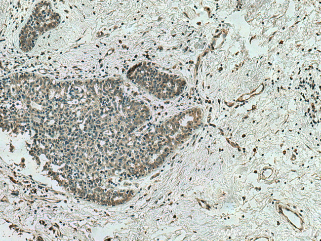 AHR Antibody in Immunohistochemistry (Paraffin) (IHC (P))