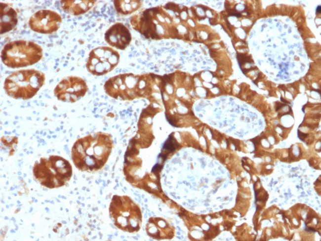 Sulfotransferase family 1E, estrogen-preferring, member 1 Antibody in Immunohistochemistry (Paraffin) (IHC (P))