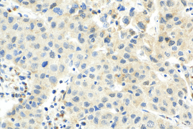 CDK7 Antibody in Immunohistochemistry (Paraffin) (IHC (P))