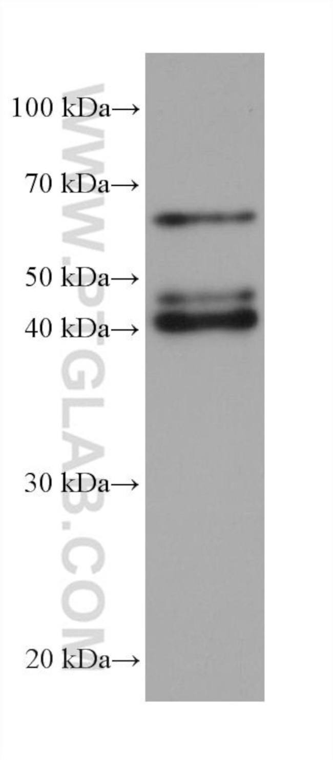 PAIP1 Antibody in Western Blot (WB)