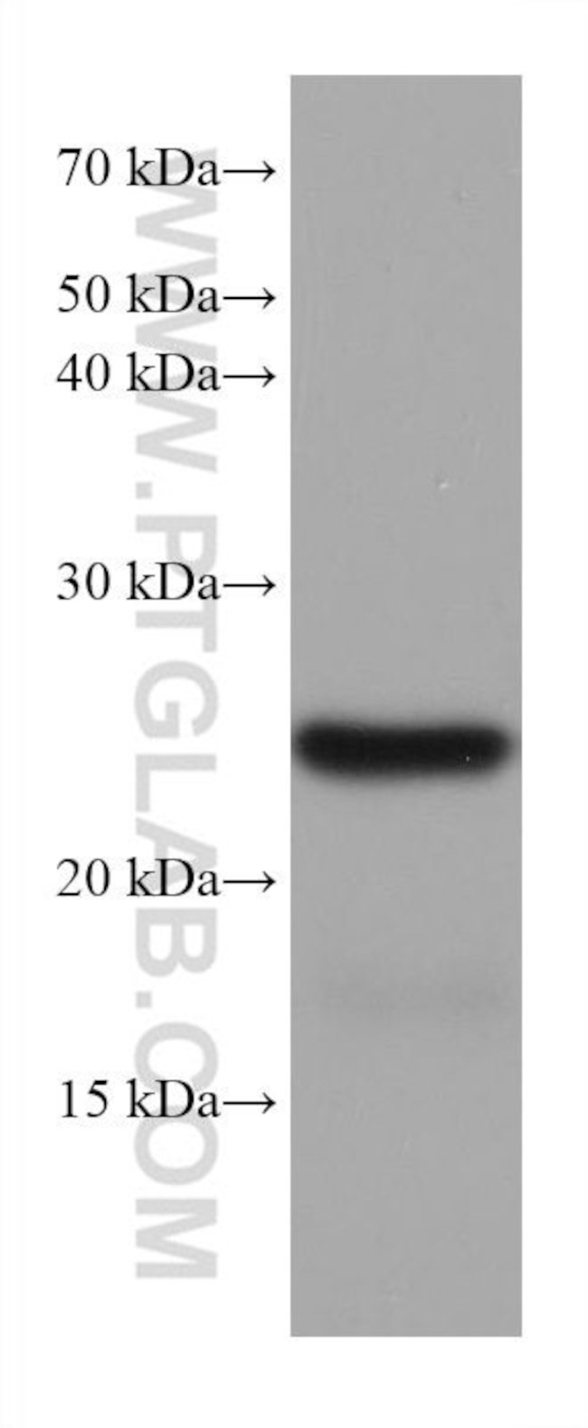 TPPP Antibody in Western Blot (WB)