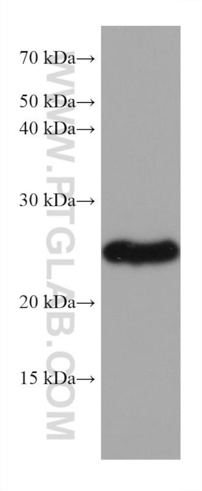 TPPP Antibody in Western Blot (WB)