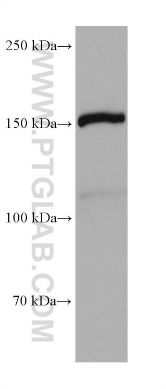 SMG6 Antibody in Western Blot (WB)