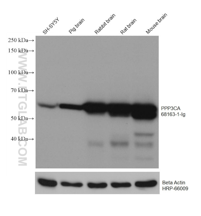 PPP3CA Antibody in Western Blot (WB)