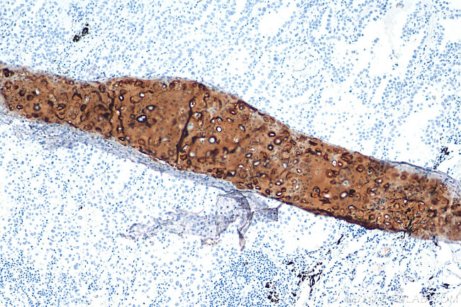 ACAN Antibody in Immunohistochemistry (Paraffin) (IHC (P))