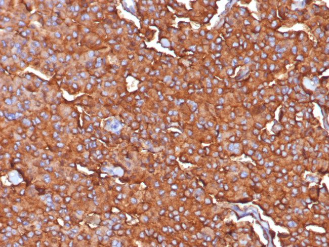 Synaptophysin (Neuroendocrine Marker) Antibody in Immunohistochemistry (Paraffin) (IHC (P))