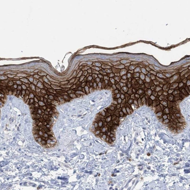 Desmocollin 3 Antibody in Immunohistochemistry (IHC)