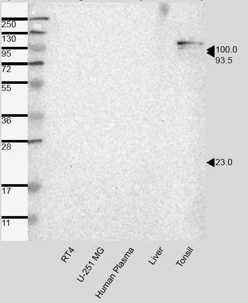 Desmocollin 3 Antibody in Western Blot (WB)