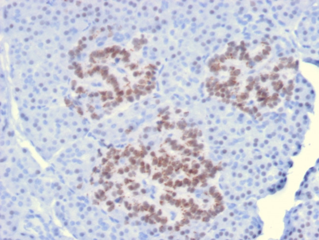 HNF1A (Pancreatic Tumor Suppressor) Antibody in Immunohistochemistry (Paraffin) (IHC (P))