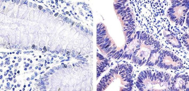 IRAK4 Antibody in Immunohistochemistry (Paraffin) (IHC (P))