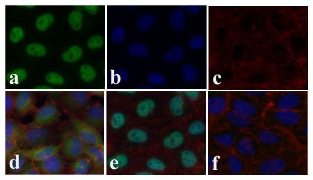 SMAD2 Antibody in Immunocytochemistry (ICC/IF)