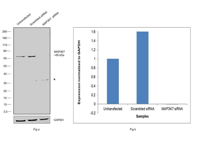 TAK1 Antibody in Western Blot (WB)