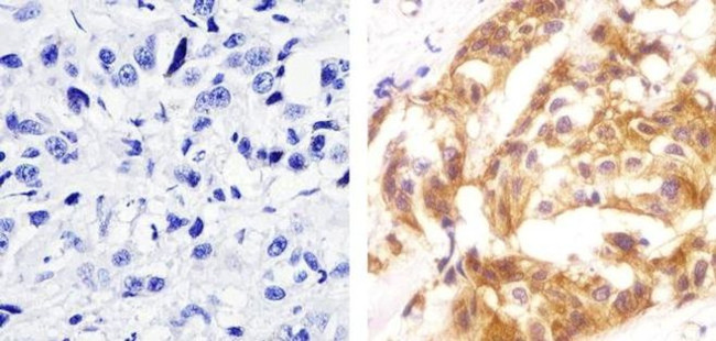 Phospho-c-Met (Tyr1230, Tyr1234, Tyr1235) Antibody in Immunohistochemistry (Paraffin) (IHC (P))