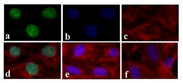 STAT4 Antibody in Immunocytochemistry (ICC/IF)