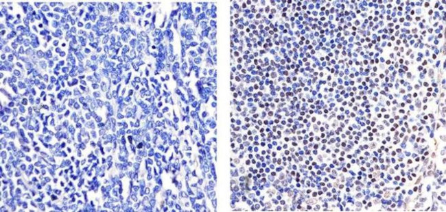 IRF2 Antibody in Immunohistochemistry (Paraffin) (IHC (P))