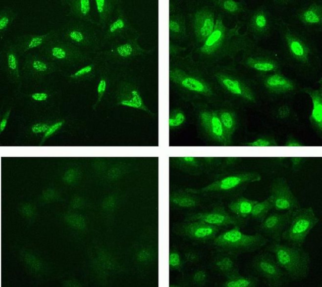 Phospho-STAT6 (Tyr641) Antibody in Immunocytochemistry (ICC/IF)