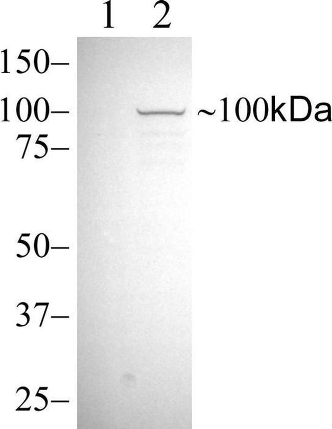 Phospho-STAT6 (Tyr641) Antibody in Western Blot (WB)