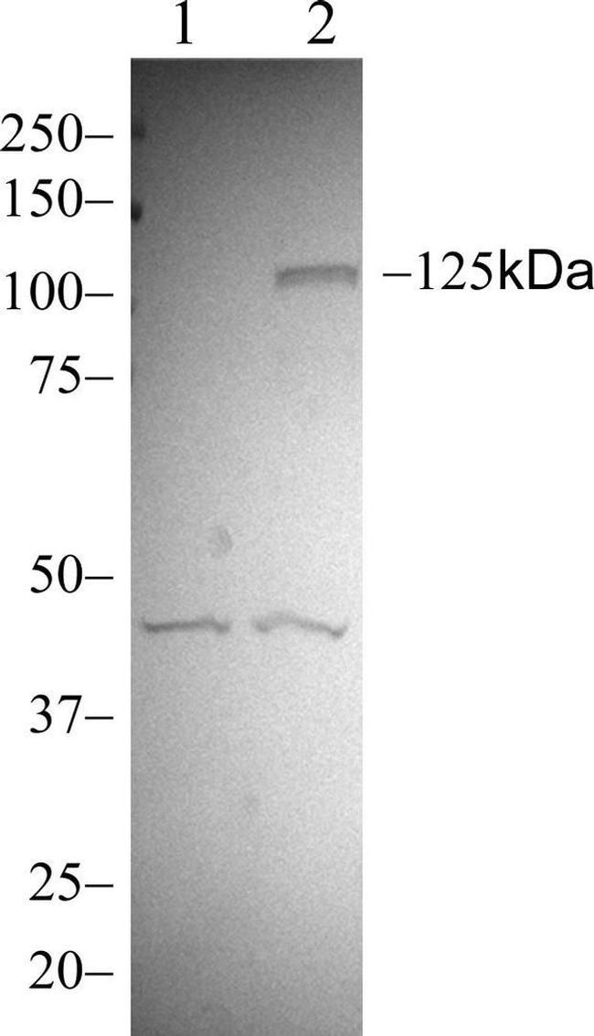 Phospho-FAK (Tyr397) Antibody in Western Blot (WB)