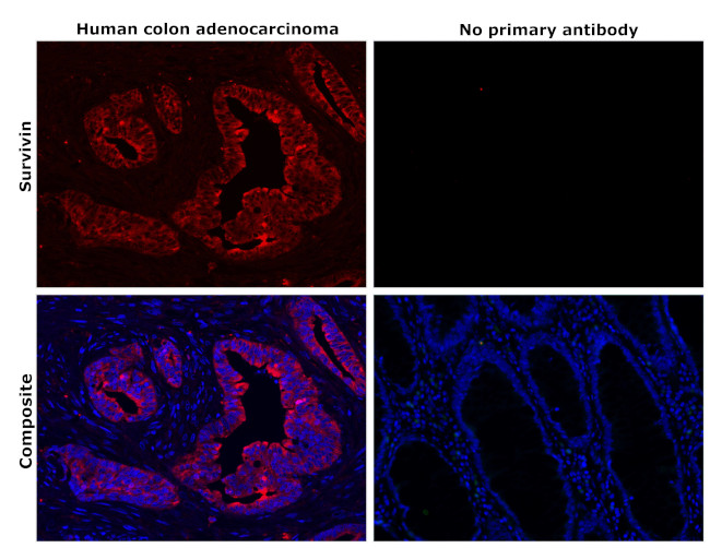 Survivin Antibody in Immunohistochemistry (Paraffin) (IHC (P))