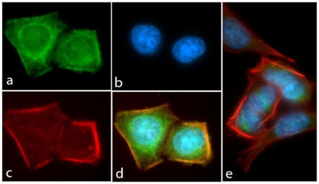 Phospho-AKT1 (Thr308) Antibody in Immunocytochemistry (ICC/IF)