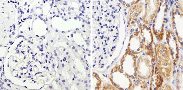 IkB alpha Antibody in Immunohistochemistry (Paraffin) (IHC (P))