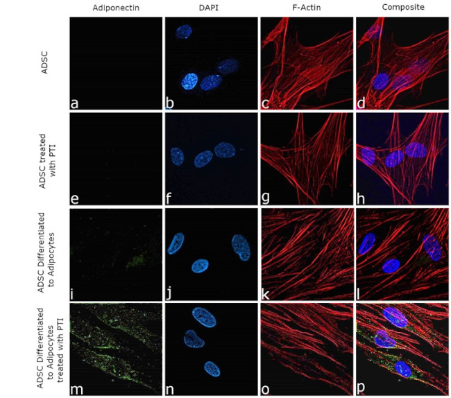 Adiponectin Antibody in Immunocytochemistry (ICC/IF)