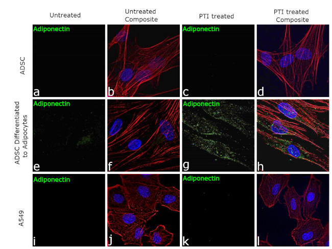 Adiponectin Antibody