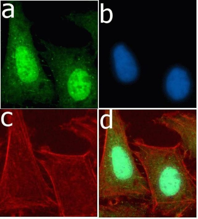 Ubiquitin Antibody in Immunocytochemistry (ICC/IF)