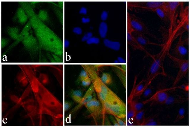 Alpha-Smooth Muscle Actin Antibody in Immunocytochemistry (ICC/IF)