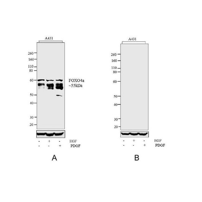 Phospho-FOXO4 (Thr28) Antibody in Western Blot (WB)