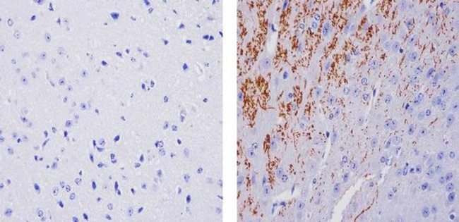 Tyrosine Hydroxylase Antibody in Immunohistochemistry (Paraffin) (IHC (P))