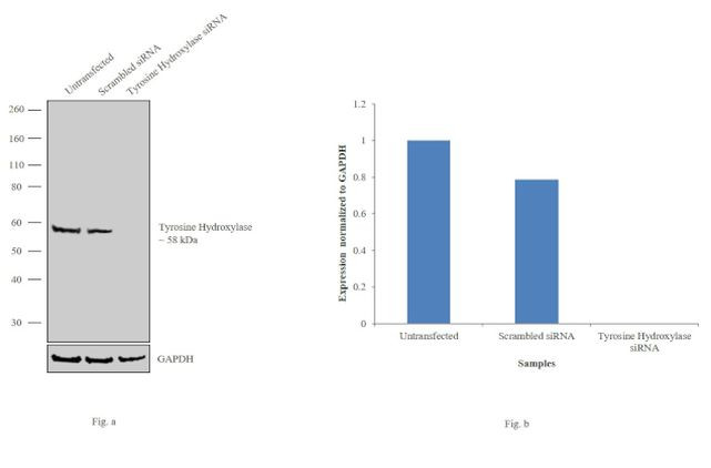 Tyrosine Hydroxylase Antibody