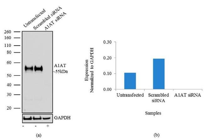 alpha-1 Antitrypsin Antibody in Western Blot (WB)