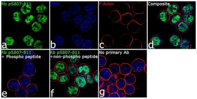 Phospho-Rb (Ser807, Ser811) Antibody in Immunocytochemistry (ICC/IF)