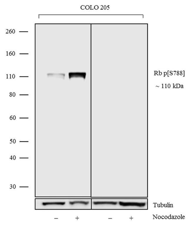 Phospho-Rb (Ser788) Antibody
