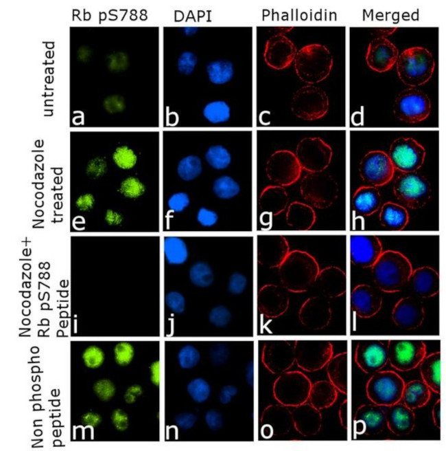 Phospho-Rb (Ser788) Antibody in Immunocytochemistry (ICC/IF)