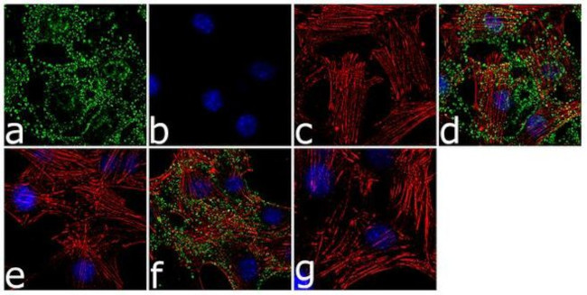 Phospho-GSK3 alpha/beta (Tyr279, Tyr216) Antibody in Immunocytochemistry (ICC/IF)