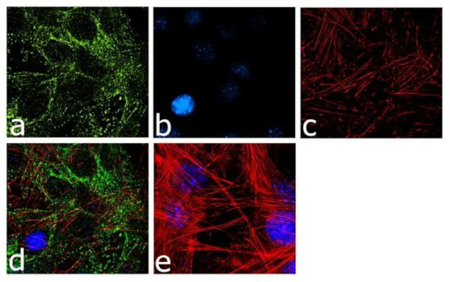 Laminin-221 Antibody in Immunocytochemistry (ICC/IF)