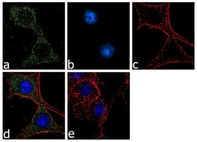 Calbindin D28K Antibody in Immunocytochemistry (ICC/IF)