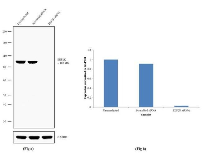 EEF2K Antibody in Western Blot (WB)