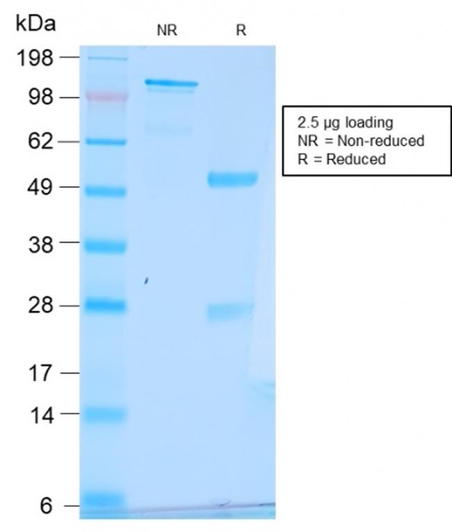 pS2/pNR-2/TFF1 (Estrogen-Regulated Protein) Antibody in SDS-PAGE (SDS-PAGE)