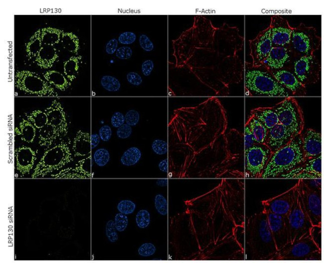 LRP130 Antibody in Immunocytochemistry (ICC/IF)