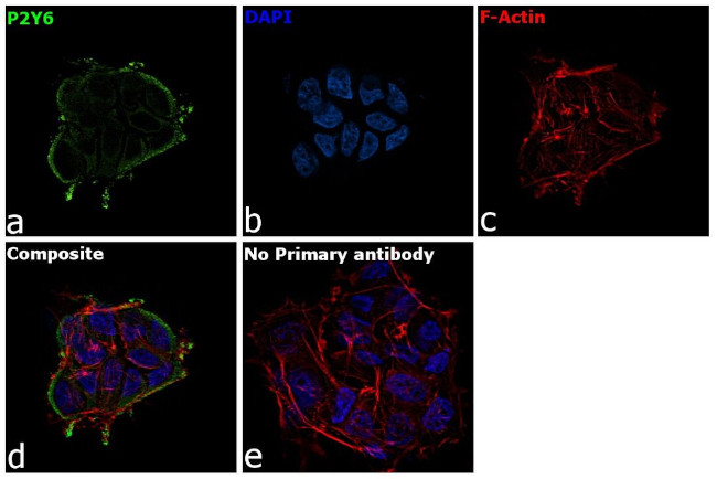 P2Y6 Antibody in Immunocytochemistry (ICC/IF)