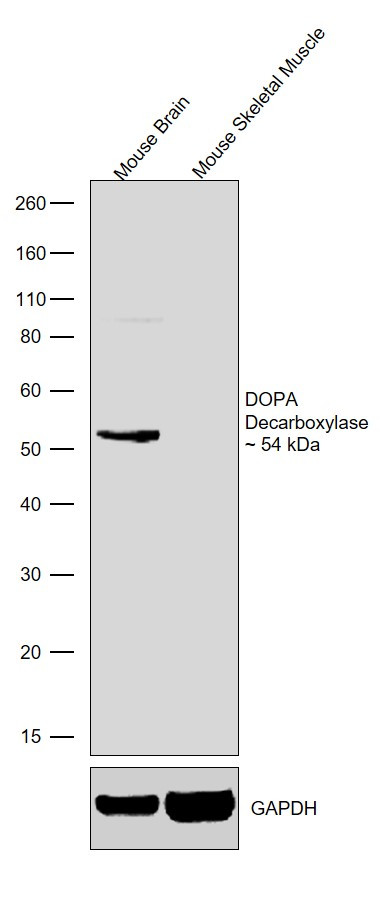 DOPA decarboxylase Antibody
