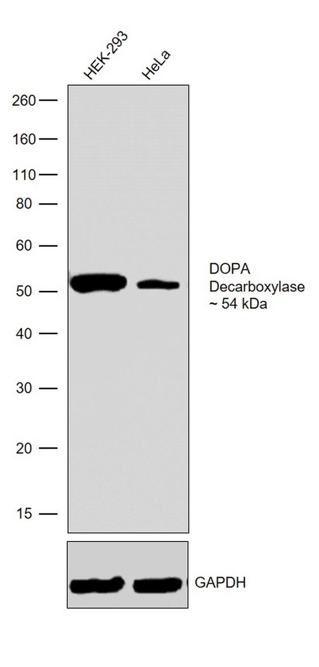DOPA decarboxylase Antibody in Western Blot (WB)